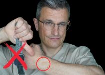 Warum ich meine Apple Watch nicht mehr trage – Dermatologische Risiken erklärt. Dr. Kasten